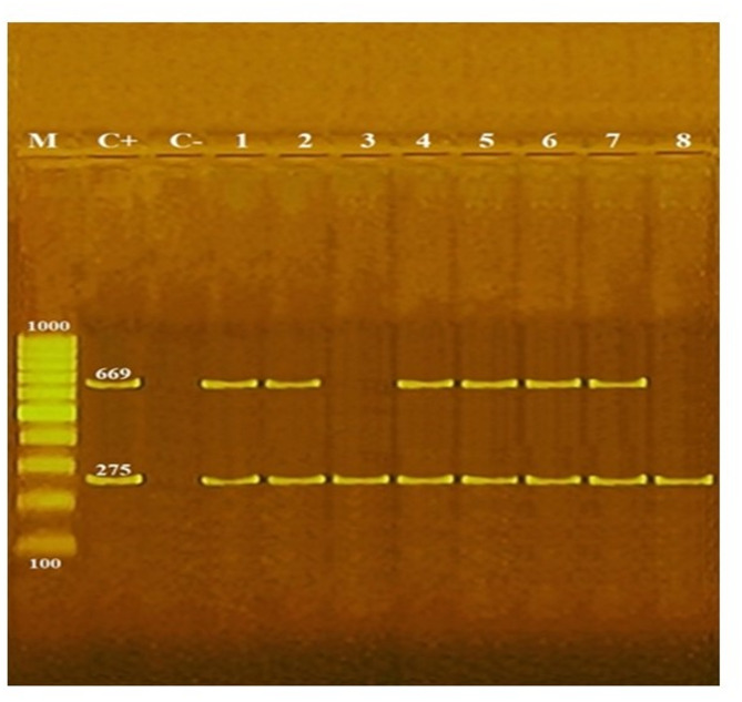 Pan-drug, colistin, streptomycin, erythromycin, clindamycin resistant Salmonella enterica serovars isolated from slaughtered cattle and human in mansoura, Egypt.