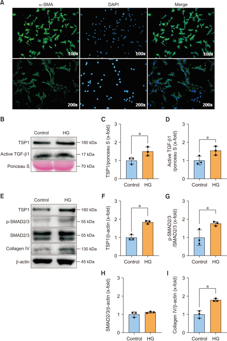 Blocking TSP1 Ameliorates Diabetes Mellitus-Induced Erectile Dysfunction by Inhibiting the TGF-β/SMAD Pathway.