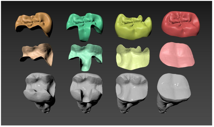 The Integration of Micro-CT Imaging and Finite Element Simulations for Modelling Tooth-Inlay Systems for Mechanical Stress Analysis: A Preliminary Study.