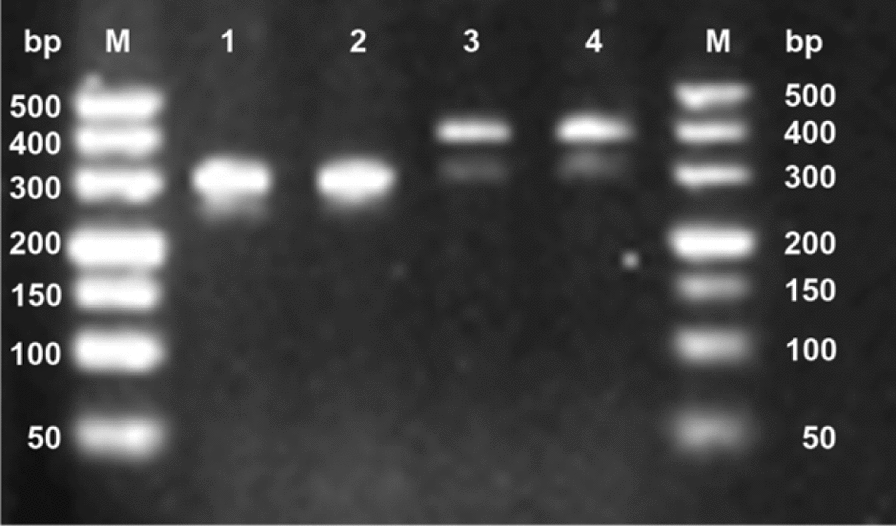 Rare Naegleria fowleri meningoencephalitis diagnosed via combined molecular biology and metagenomic sequencing techniques: a case report.