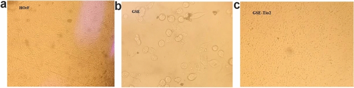 Synthesis, characterization and evaluation of experimental dental composite resin modified by grapefruit seed extract-mediated TiO₂ nanoparticles: green approach.