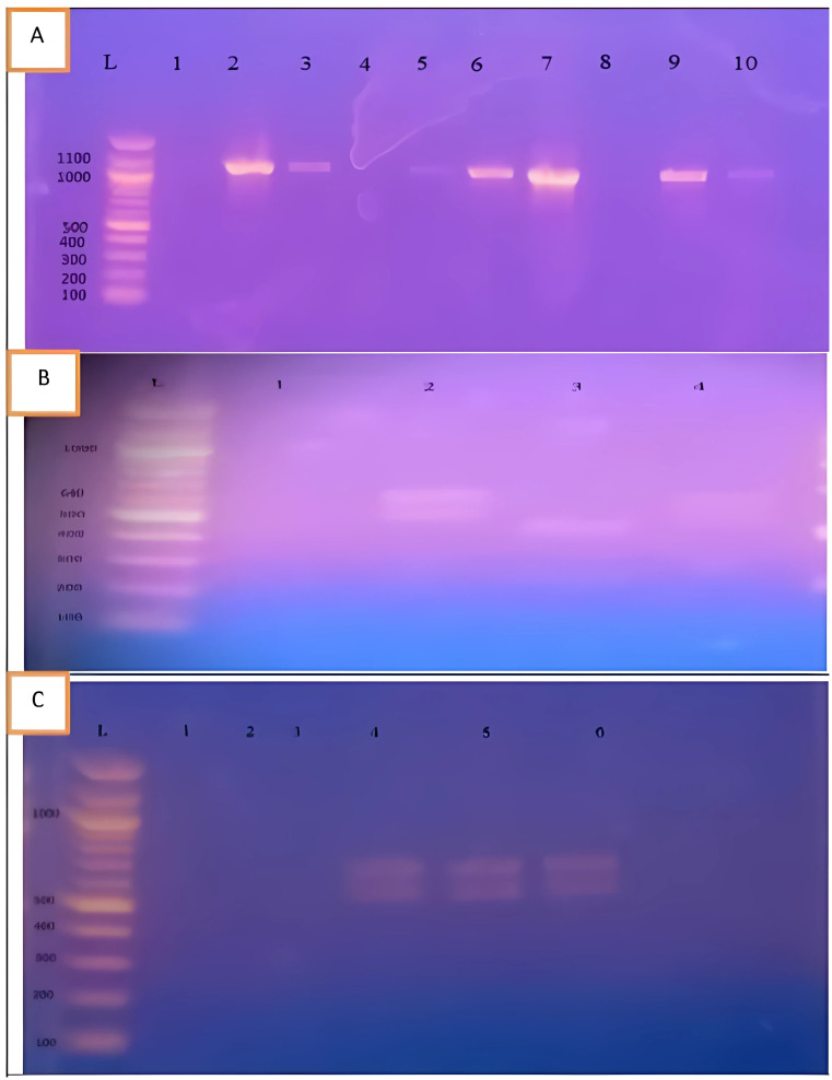 Insights into the Association Between Blastocystis Infection and Colorectal Cancer