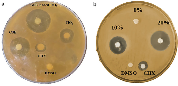 Synthesis, characterization and evaluation of experimental dental composite resin modified by grapefruit seed extract-mediated TiO₂ nanoparticles: green approach.