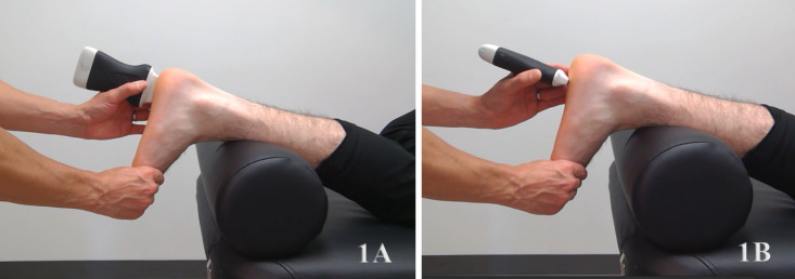 Diagnostic Musculoskeletal Ultrasound in the Evaluation of the Plantar Fascia.