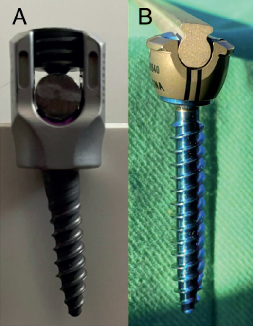 Mechanical axial instability of segmental pedicle screw instrumentation for adolescent idiopathic scoliosis: a retrospective cohort study of tulip screw versus dual locking cup instrumentation.