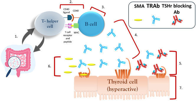 The evolving therapeutic landscape of Graves' disease in adults: present and future.
