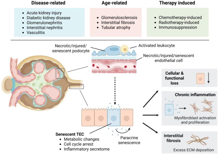Understanding and targeting senescence in kidney disease.