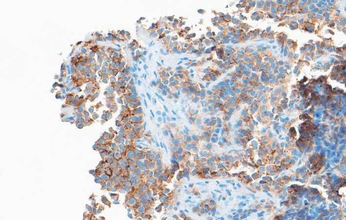 Nectin-4-Targeting Radiotracers: Novel Theranostic Agents for Precision Oncology in Cancer.