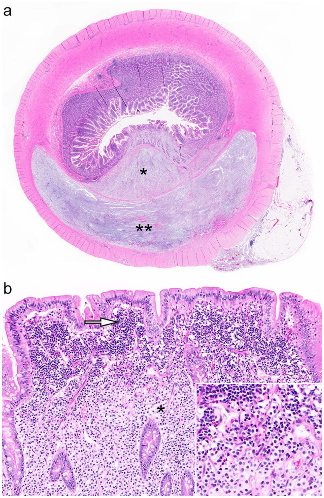 Standardized classification of synchronous gastrointestinal small cell lymphoma and gastrointestinal mast cell tumors in 15 cats.
