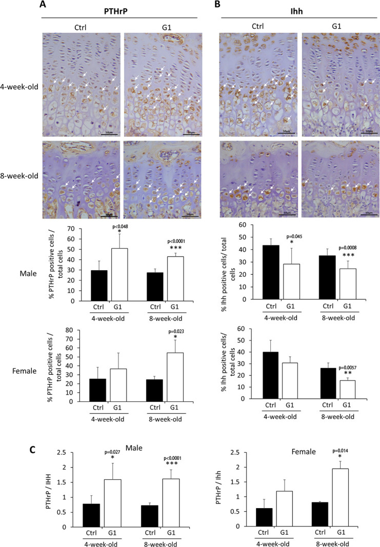 G-protein-coupled estrogen receptor-1 facilitates chondrocyte proliferation in pubertal epiphyseal growth plate via PTHrP/Ihh regulation.
