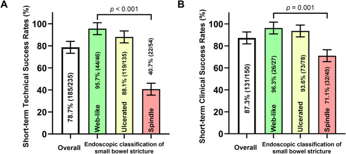 Enteroscopic Balloon Dilation in Small Bowel Stricturing Crohn's Disease: Long-Term Outcomes and Risk Factors for Surgery in a Single-Center Prospective Observational Study.