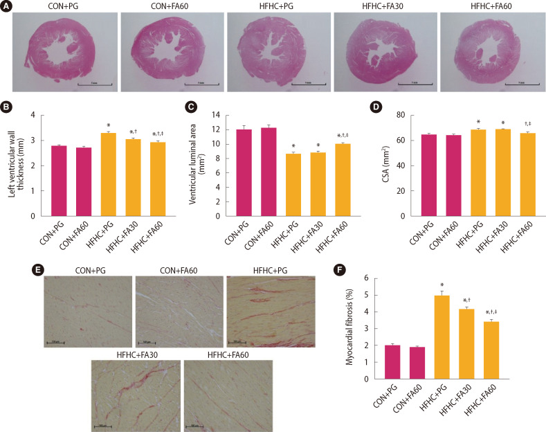 Ferulic Acid Attenuates Aortic Stiffening and Cardiovascular Remodeling by Suppressing Inflammation and the Renin-Angiotensin System in Rats Fed a High-Fat/High-Carbohydrate Diet.