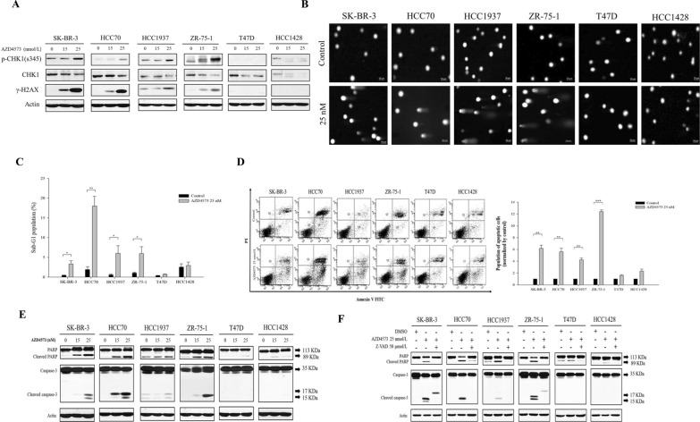 Cyclin dependent kinase 9 inhibitor induces transcription-replication conflicts and DNA damage accumulation in breast cancer.
