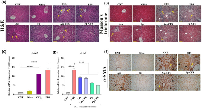 Comparative study of liver injury protection by Akkermansia muciniphila and Faecalibacterium prausnitzii interventions in live and cell-free supernatant forms via targeting the hepcidin - ferroportin axis in mice with CCl₄-induced liver fibrosis.