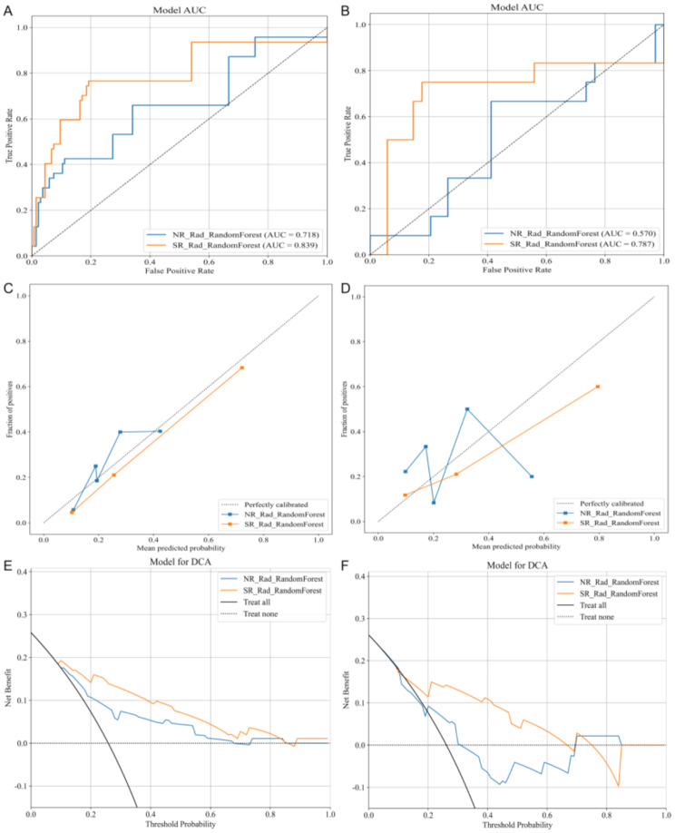The application of super-resolution ultrasound radiomics models in predicting the failure of conservative treatment for ectopic pregnancy.
