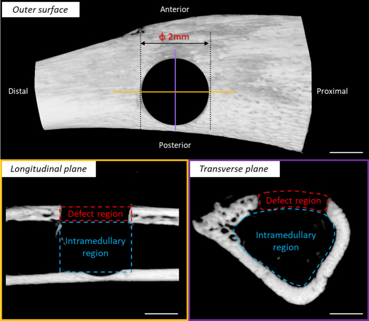 Non-contact electrical stimulation via a Vector-potential transformer promotes bone healing in drill-hole injury model.