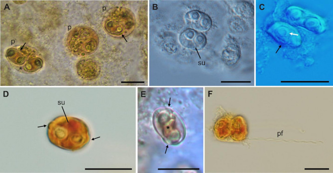 Description of Ellipsomyxa prima n. sp. in the gallbladder of Gambusia yucatana (Cyprinodontiformes: Poeciliidae) from freshwater springs in the Yucatán Peninsula, Mexico.