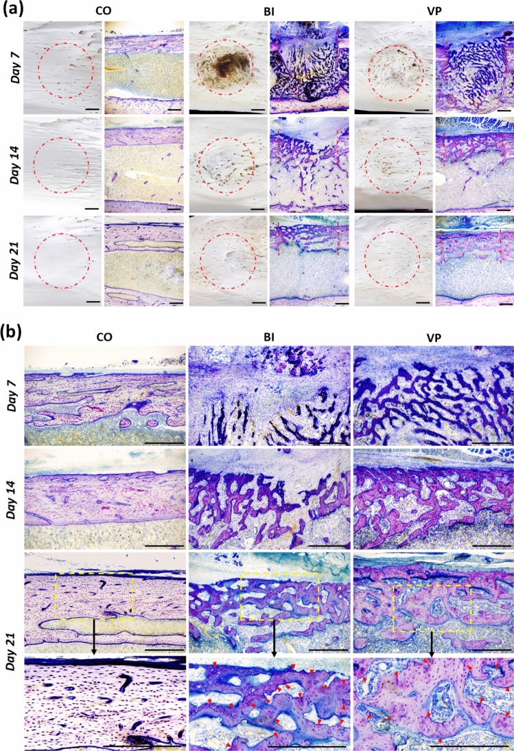 Non-contact electrical stimulation via a Vector-potential transformer promotes bone healing in drill-hole injury model.