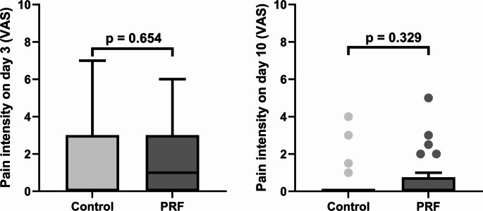 Effect of platelet-rich fibrin on microperfusion during early socket healing: a randomized controlled clinical trial.