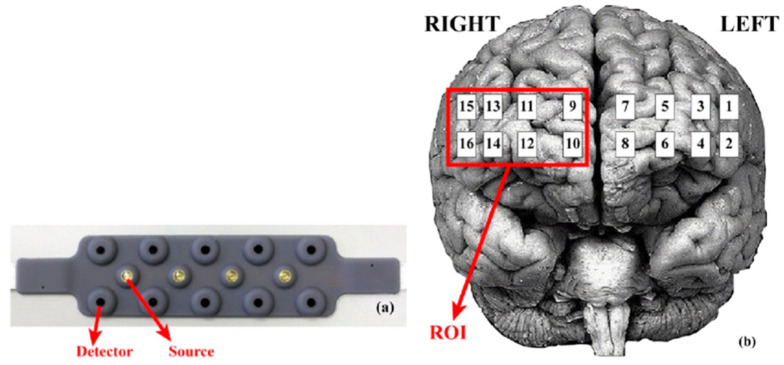 Effectiveness of a Cognitive Stimulation Program in Older Adults with Mild Neurocognitive Disorder: Insights from fNIRS Analysis in a Randomized Controlled Trial.