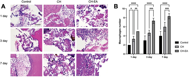 Anti-Inflammatory Effects of Calcium Hydroxide Combined with Ellagic Acid as Pulp Capping Material: In Vivo Study.