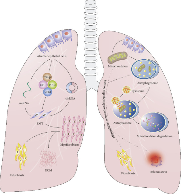 Current Understanding of Pulmonary Fibrosis: Pathogenesis, Diagnosis, and Therapeutic Approaches.
