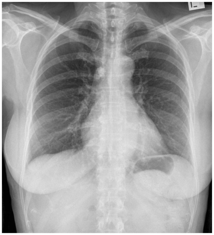 Critical Care Transport: Blunt Polytrauma in Pregnancy.