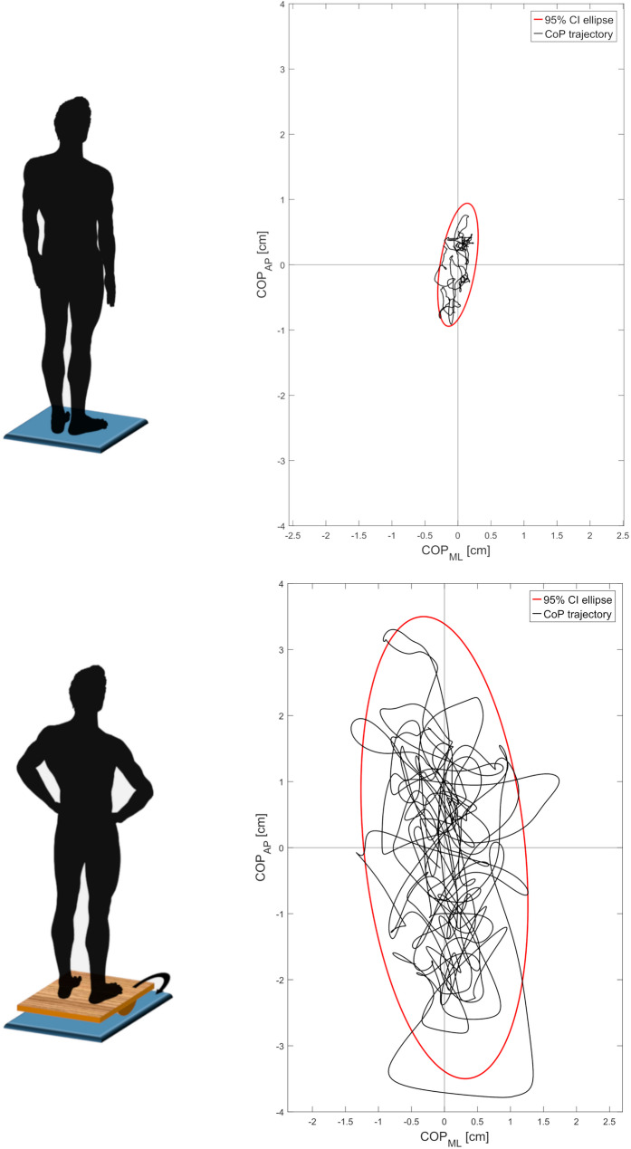 Exploring the relationship between static and dynamic balance performance through the same center-of-pressure parameters.