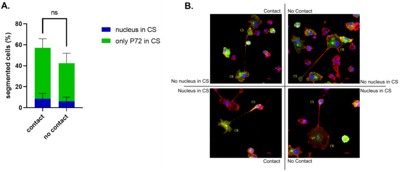 African swine fever virus infection of porcine peripheral blood monocyte-derived macrophages induces the formation of tunneling nanotube-connected large vesicle-like cell segments: a potential mechanism for intercellular ASFV trafficking.