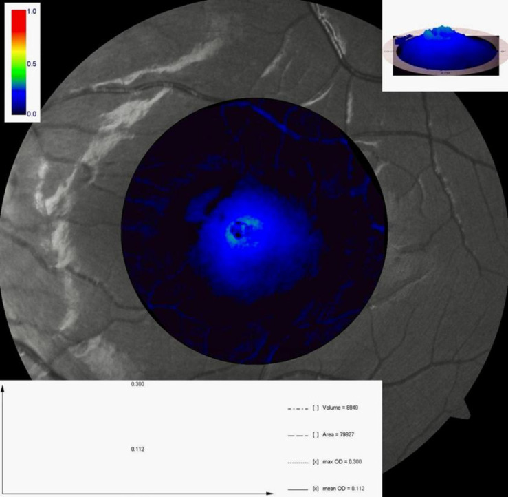 Clinical anatomy of the macula.