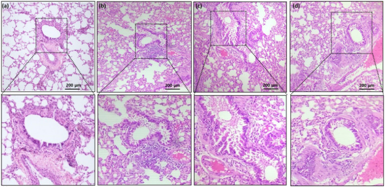 Alpha-bisabolol protects against neonatal asthma by suppressing airway inflammatory signaling.
