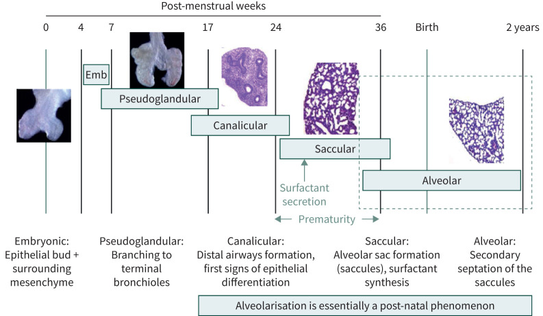 The pathogenesis of bronchopulmonary dysplasia: "It is never the heart, it is always the lung" - myth or maxim?