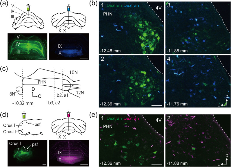 A Novel Subpopulation of Prepositus Hypoglossi Nucleus Neurons Projecting to the Cerebellar Anterior Vermis and Hemisphere in Rats.