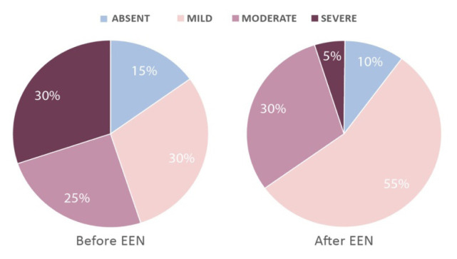 Exclusive enteral nutrition in Crohn's disease pediatric patients: from clinical remission to transmural healing.