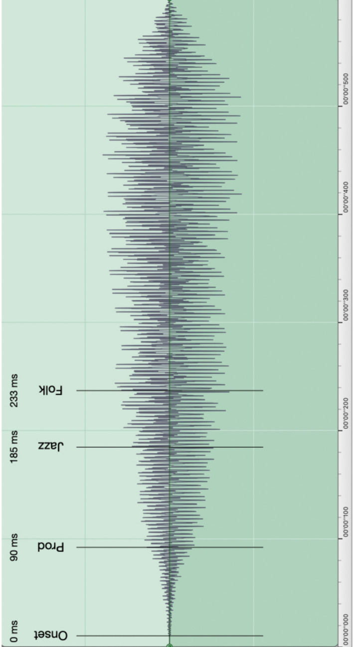 The influence of vocal expertise on the perception of microrhythm in song and speech