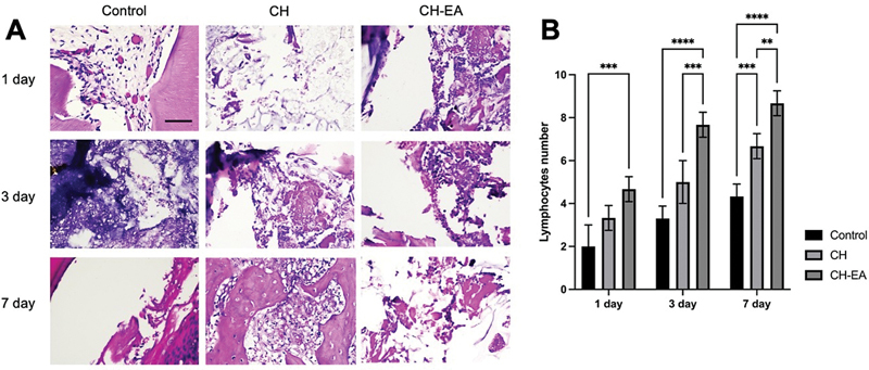 Anti-Inflammatory Effects of Calcium Hydroxide Combined with Ellagic Acid as Pulp Capping Material: In Vivo Study.