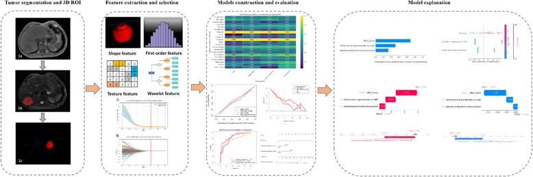 Multilayer perceptron deep learning radiomics model based on Gd-BOPTA MRI to identify vessels encapsulating tumor clusters in hepatocellular carcinoma: a multi-center study.