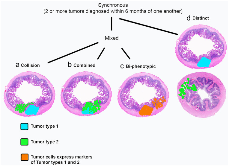 Standardized classification of synchronous gastrointestinal small cell lymphoma and gastrointestinal mast cell tumors in 15 cats.