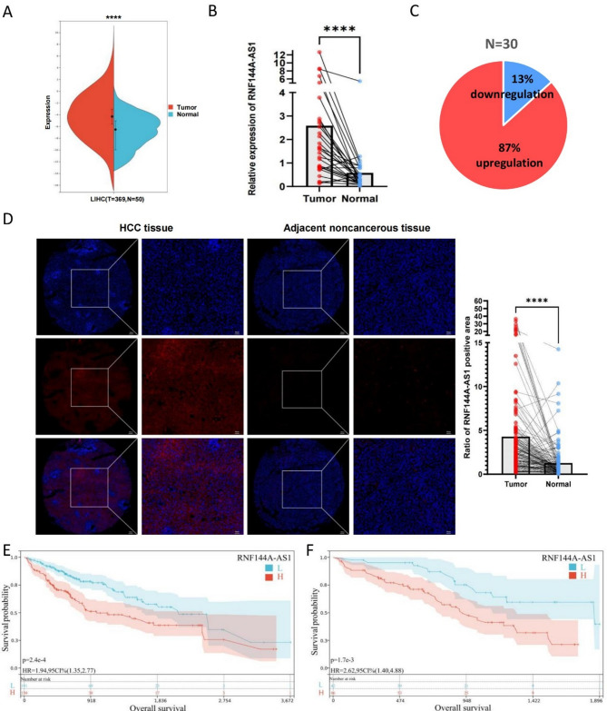 m<sup>6</sup>A methylation-mediated lncRNA RNF144A-AS1 promotes hepatocellular carcinoma progression through the miR-1301-3p/RNF38 pathway.