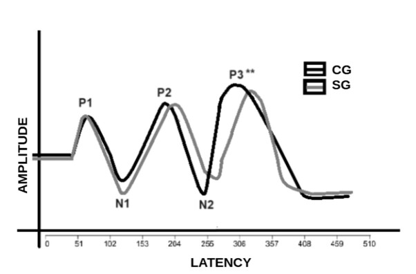 Response time, amplitude, and neural auditory maintenance in individuals with tinnitus: a comparative study.