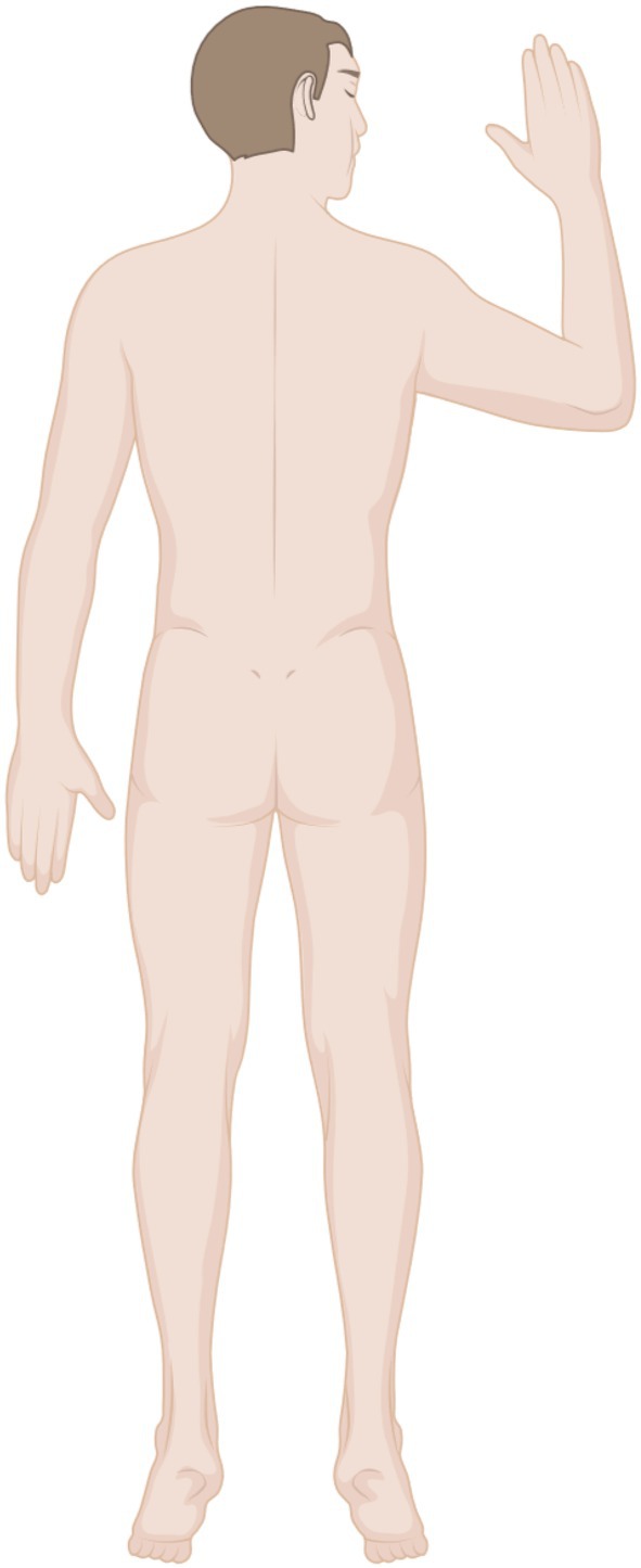 The effect of swimmer position during prone ventilation on the onset of brachial plexus injury in the intensive care unit: A multiprofessional clinical study protocol.