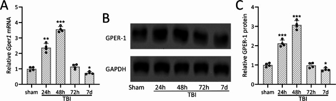 Gper1 inhibition exacerbates traumatic brain injury-induced neurological impairments in mice.