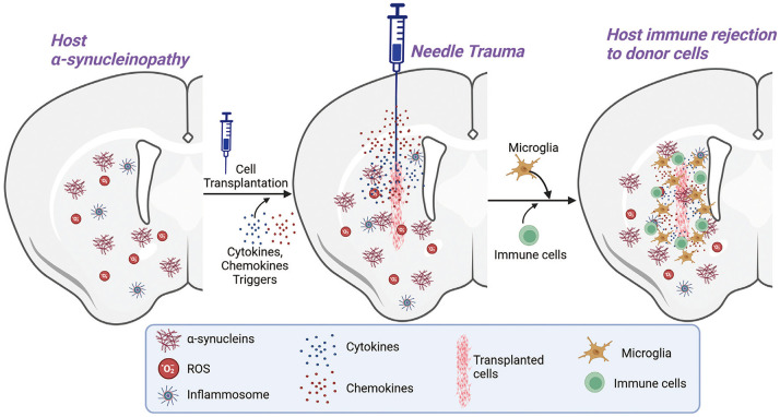 Human Pluripotent Stem Cell-Based Therapies for Parkinson's Disease: Challenges and Potential Solutions.