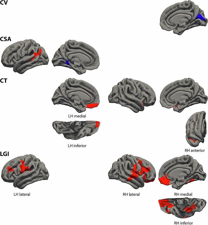 Differential structural cortical correlates of positive, negative, and linguistic control formal thought disorder dimensions in schizophrenia.