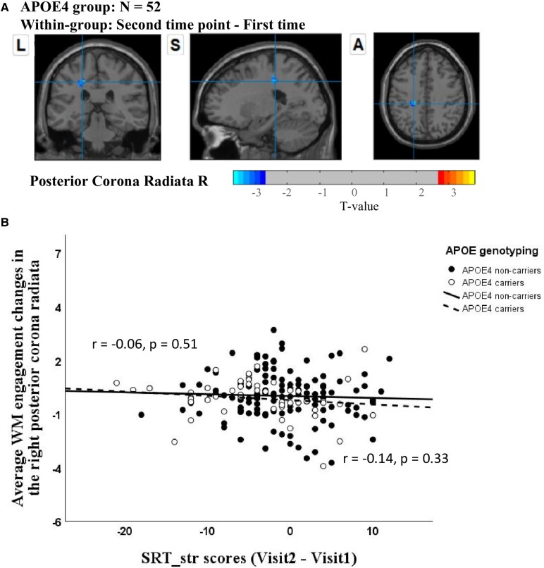 Longitudinal effects of sex differences and apolipoprotein E genotype on white matter engagement among elderly.