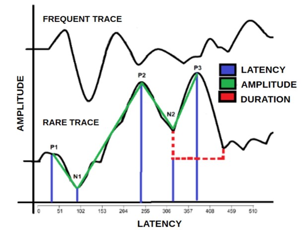 Response time, amplitude, and neural auditory maintenance in individuals with tinnitus: a comparative study.