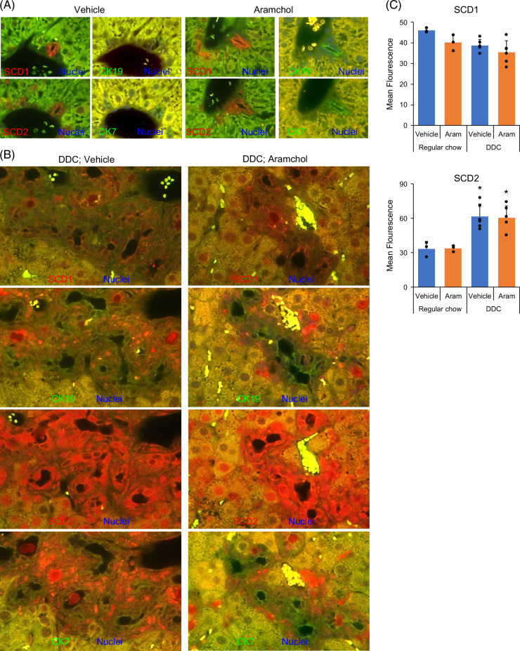 Aramchol attenuates fibrosis in mouse models of biliary fibrosis and blocks the TGFβ-induced fibroinflammatory mediators in cholangiocytes.
