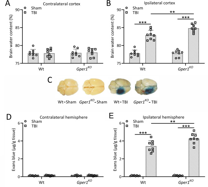 Gper1 inhibition exacerbates traumatic brain injury-induced neurological impairments in mice.