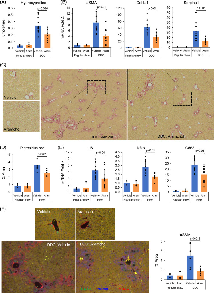 Aramchol attenuates fibrosis in mouse models of biliary fibrosis and blocks the TGFβ-induced fibroinflammatory mediators in cholangiocytes.