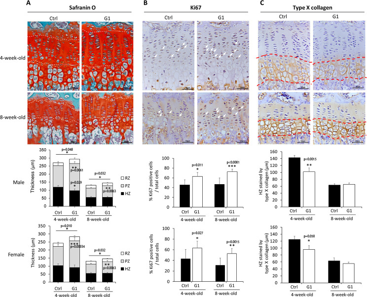 G-protein-coupled estrogen receptor-1 facilitates chondrocyte proliferation in pubertal epiphyseal growth plate via PTHrP/Ihh regulation.